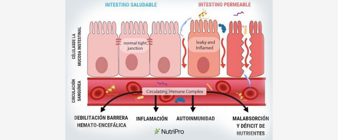 NutriPro: Tu Solución Natural ante los Desafíos del Intestino Permeable